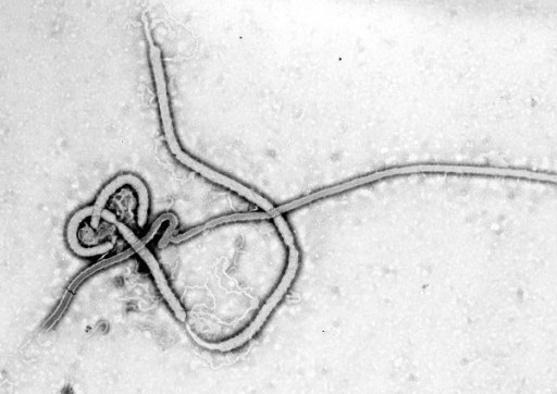 virus ebola