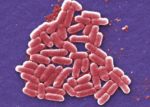 Batteri E.Coli al microscopio elettronico - © Wired.com