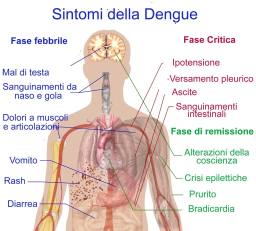 sintomi dengue