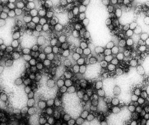 Il virus della Febbre Gialla visto al microscopio elettronico