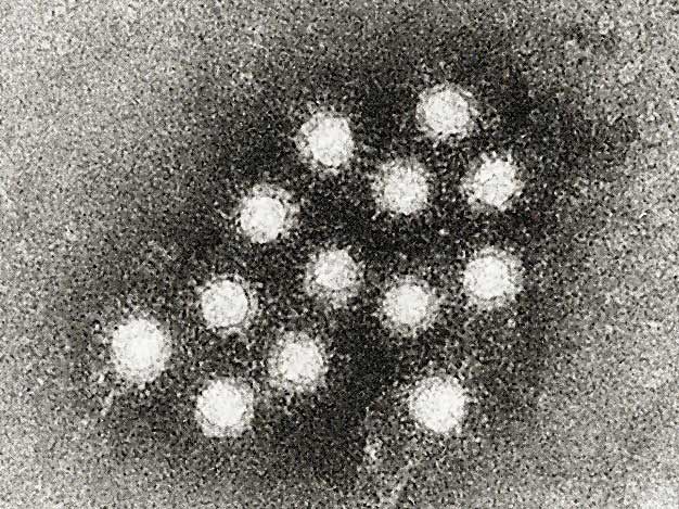 Il virus HAV al microscopio elettronico